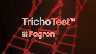 TrichoTest The First Genetic Test for Hair Loss [upl. by Hijoung]