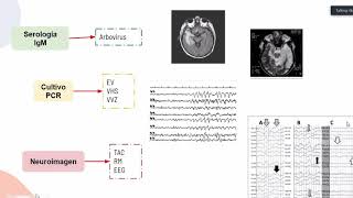 Meningoencefalitis parte 2 [upl. by Ottilie]