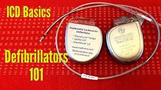 Defibrillators 101  The Basics Of An Implantable Cardioverter Defibrillator ICD [upl. by Amer413]