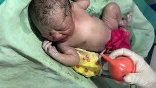 Baby you care newborn baby 👶❤️🔥viralvideo shortvideo cute doctorbantu baby trendingvideo [upl. by Ahsatan]