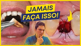 9 coisas que você JAMAIS deve fazer após EXTRAIR um dente [upl. by Winnah939]