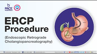 What is ERCP Test and How it is done  Department of Gastroenterology  Pace Hospitals [upl. by Paris24]