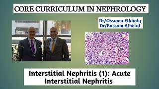 Interstitial Nephritis 1 Acute Interstitial Nephritis DrOssama Elkholy [upl. by Birch]