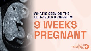 Week 9 of Pregnancy Ultrasound Brain Heart amp Gender Development [upl. by Llain16]