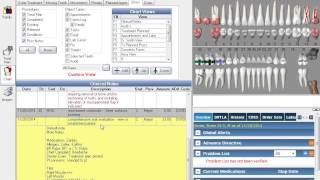 Open Dental Clinical Training for eClinicalWorks Users [upl. by Linden]