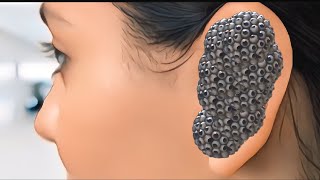 Remove ASMR sleep 💤 mood bee 🐝 sting Big yellow 🟡 infected ka ear 👂 deep cleaning asmr animation [upl. by Moreno460]