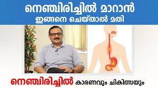 നെഞ്ചിരിച്ചിൽ മാറാൻ ഇങ്ങനെ ചെയ്താൽ മതി  Acid reflux malayalam  Gas Trouble [upl. by Ecinreb613]