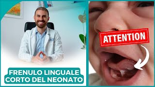 FRENULO LINGUALE CORTO DEL NEONATO Cosè come riconoscerlo le conseguenze e cosa fare [upl. by Tloc]