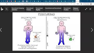 Decorticate and Decerebrate posturingNCLEX Exam Nursing Medical Student [upl. by Hoban]