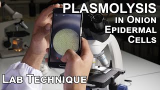 Plasmolysis in Onion Epidermal Cells  Biology Lab Techniques [upl. by Negaet]