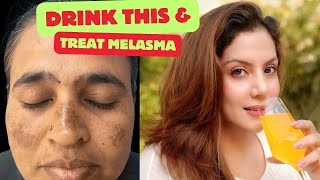 Drink this to treat Melasma amp Pigmentation  Nipun Kapur [upl. by Amoeji]