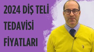 ‼️2024 DİŞ TELİ TEDAVİSİ FİYATLARI ‼️ [upl. by Lasiaf]