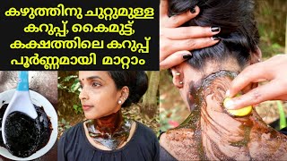 Remove darknesspigmentation around neckampunderarms❤Best dark neck treatment❤kazhuthile karupu mattam [upl. by Federico105]