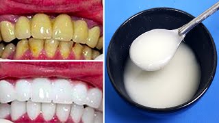 Blanchir Les Dents En 2 Minutes Avec Ce Mélange Et Obtenir Des Dents Blanches Naturelles [upl. by Mohr196]