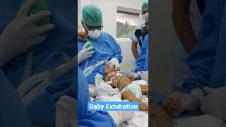 Baby Extubation after surgery [upl. by Ackley873]