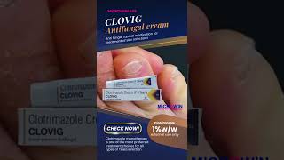 Clovig antifungal cream with Clotrimazole [upl. by Coulter]