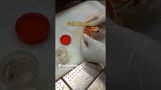 Gall bladder specimen cutting 🧐👀 [upl. by Nyleve]