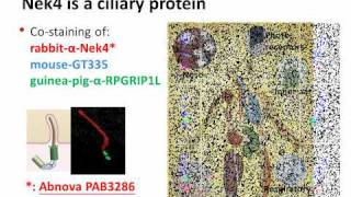 The Ciliopathyassociated Protein Homologs RPGRIP1 [upl. by Suolekcin]