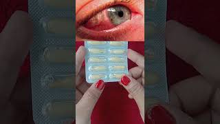 Chloramphenicol Eye Ointment Ip shorts eyeinfection viralshorts [upl. by Repohtsirhc]