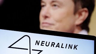 Firma von Elon Musk darf GehirnImplantate am Menschen testen [upl. by Eelah869]