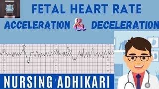 DECELERATION OF FETAL HEART RATE Early  Late and variable Acceleration ।। Mnemonic VEAL CHOP ।। [upl. by Alejna775]