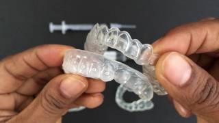 How to use Tooth Whitening Trays [upl. by Eimrots431]