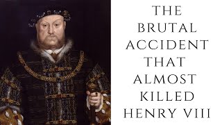 The BRUTAL Accident That Almost Killed Henry VIII [upl. by Nosidam]