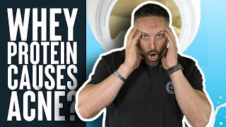 Whey Protein Causes Acne  Educational Video  Biolayne [upl. by Yecam770]