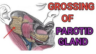 Grossing of Parotid Gland ।। Grossing [upl. by Edla32]