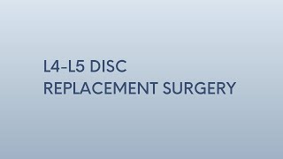 L4L5 Disc Replacement Surgery  Patient Success Story  Minnesota Spine Institute [upl. by Paschasia]