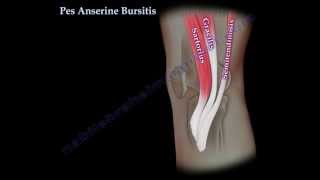 Pes Anserine Bursitis  knee pain  Everything You Need To Know  Dr Nabil Ebraheim [upl. by Rockefeller]