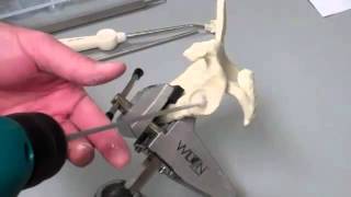 Inlay Glenoid technique demo internal use [upl. by Phil]