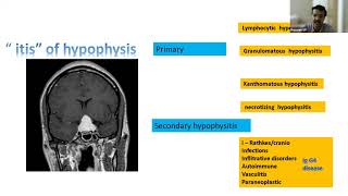 HYPOPHYSITIS ESB 4E WEBINAR 291021 [upl. by Laveen]