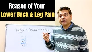 Disc Bulge Sciatica Lumbar Canal Stenosis What is your Diagnosis Lower Back amp Leg Pain Causes [upl. by Donall657]