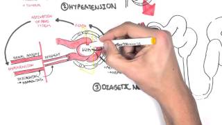 Chronic Kidney Disease CKD Pathophysiology [upl. by Ardnua115]