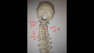 Cervical Right Rotation C4 on C5 [upl. by Atekahs]