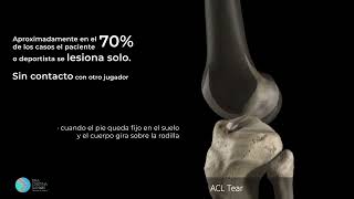 LESION DEL LIGAMENTO CRUZADO ANTERIOR [upl. by Sucramd]