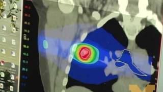 UM Radiation Oncology Individualized Care [upl. by Drye]