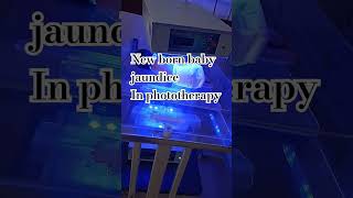 Baby jaundice Phototherapy 🥺 shorts shortvideo newbornbaby youtubeshorts viral [upl. by Annyahs27]