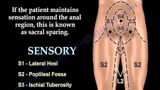 Sacral Sparing  Everything You Need To Know  Dr Nabil Ebraheim [upl. by Wj202]