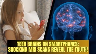 Teen Brains on Smartphones Shocking MRI Scans Reveal the Truth  Most Viral Today [upl. by Rotsen]