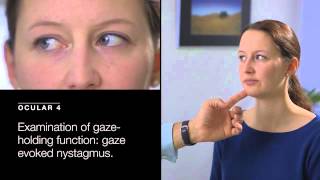 Examination of Gaze Holding Deficit Gaze Evoked Nystagmus [upl. by Aramenta]