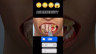 The Most Satisfying Teeth ASMR  viralytshortsyoutube [upl. by Pip828]