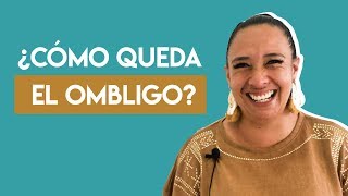 ¿como queda el ombligo después de una abdominoplastia [upl. by Kentigerma]