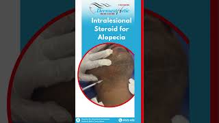 Intralesional Steroids for Alopecia by Dr Bushra Bashir skincare beauty [upl. by Alolomo]