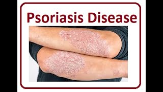 Psoriasis Symptoms Cause  2024 [upl. by Aticnemrac448]