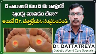 కాళ్లలో పుండ్లు మానడం లేదా  Chronic Leg Ulcers Symptoms  Dr Dattatreya  Wound Care Hospitals [upl. by Ellenwad]