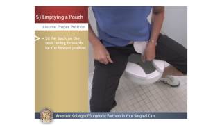 ColostomyIleostomy Emptying a Pouch [upl. by Goeselt]