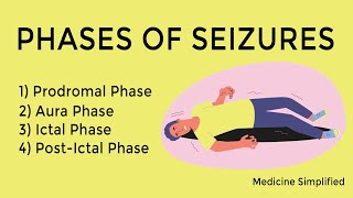 Seizure phases  Phase of seizures  Stages of Seizures  Seizure stages [upl. by Rezzani748]