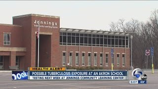 Akron Middle School under tuberculosis watch [upl. by Symon]